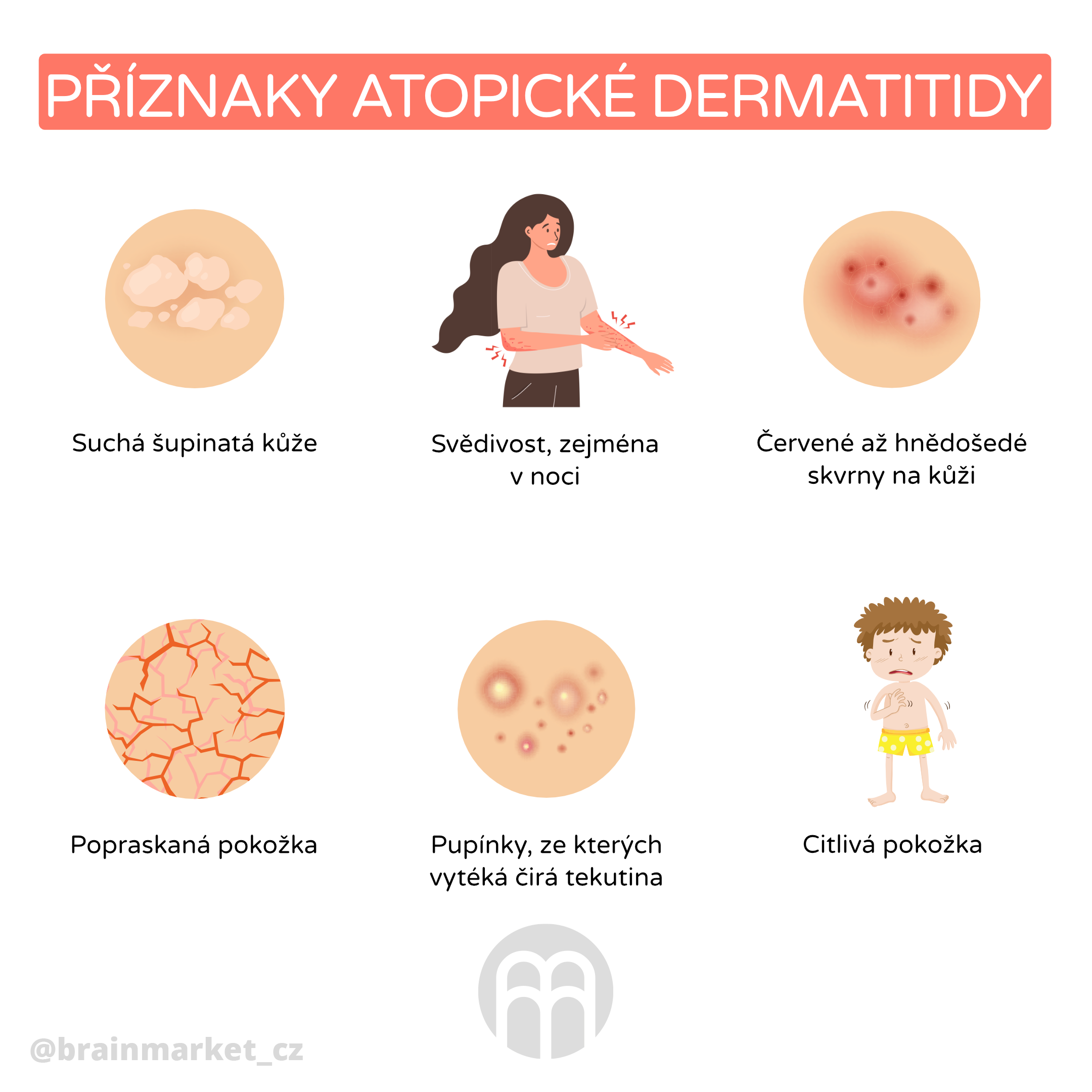 atopicka dermatitida_infografika_cz_1